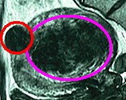 縦スライスのＭＲＩ